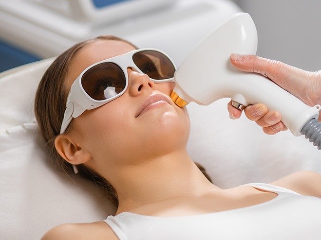 Laser Hair Removal in Rockville glimsera